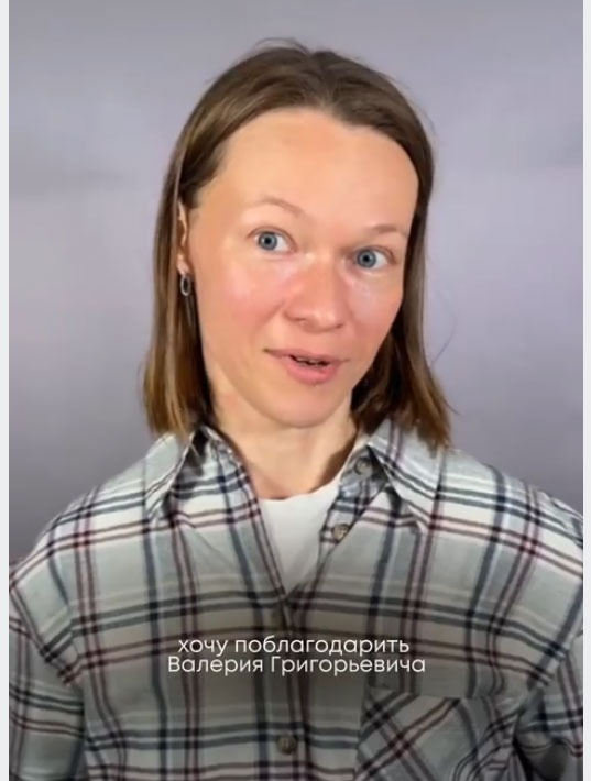 Эндоскопический лифтинг средней зоны лица - Видео превью
