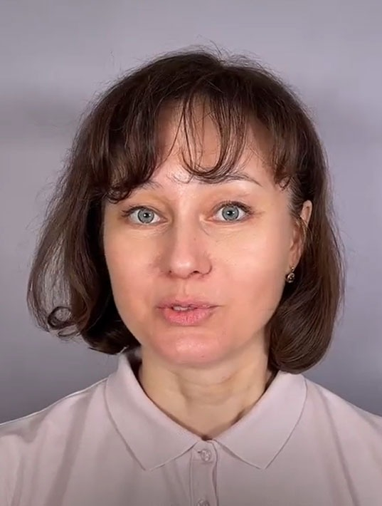 Эндоскопический лифтинг лба, Эндоскопический лифтинг средней зоны лица, Блефаропластика нижних век - Видео превью