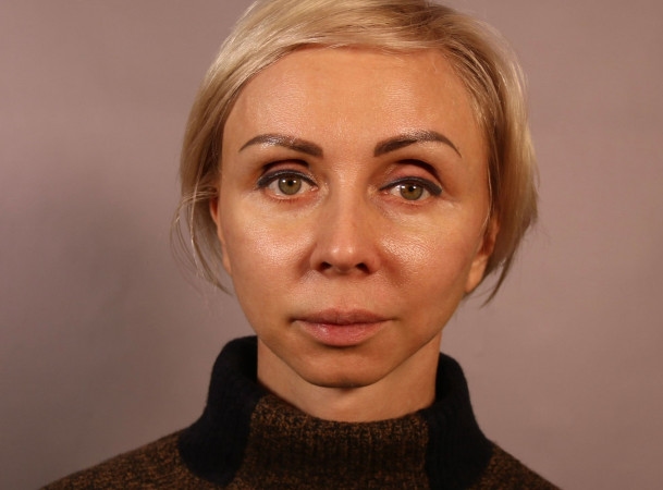 После