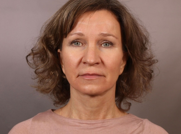 После